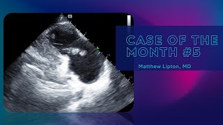 Case of the month 5 [upl. by Edlyn955]