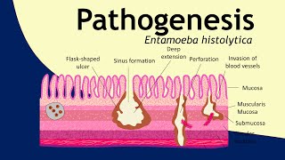 Pathogenesis of Entamoeba histolytica  parasitology  Basic Science Series [upl. by Dot352]