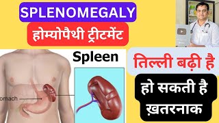 स्प्लीन या तिल्ली बढ़ने के लक्षण और होम्योपैथी ट्रीटमेंट । Treatment of spleen enlargement । [upl. by Cassady]