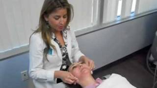 Ultherapy in San Diego  Skin Tightening  Dr Sabrina Fabi [upl. by Cyrie814]