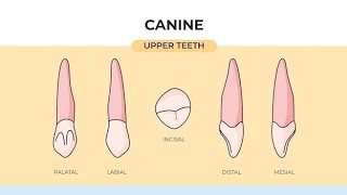 Cutting Maxillary Canine with KH Tanta 🔥 [upl. by Ennaerb]