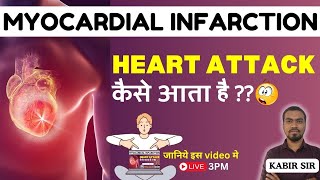 MYOCARDICAL INFARCTION HEART ATTACK कैसे आता है  IN HINDI GNM  GNM COURSE BY BHUSHAN SCIENCE [upl. by Amitarp847]