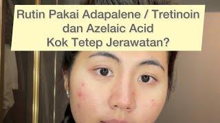 Rutin Pakai Adapalene  Tretinoin amp Azelaic Acid Kok Tetap Jerawatan [upl. by Iroc]