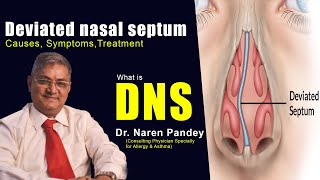 Deviated nasal septumDNS in Bangla নাকের হাড় ব্যাঁকায় করনীয় [upl. by Yenreit780]