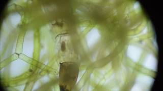 Texas Pond Water amp MOSQUITO Larvae Under A MICROSCOPE [upl. by Saiff]