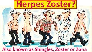 What is Herpes Zoster [upl. by Haimerej]