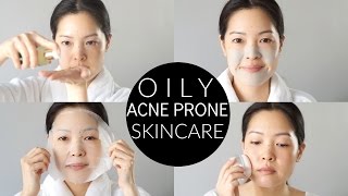 Basic Oily amp AcneProne Skincare Routine and Essentials [upl. by Ahsiket]