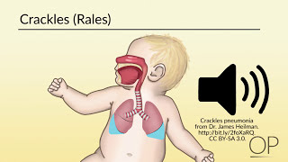 Respiratory Assessment by B Leary L DelSignore  OPENPediatrics [upl. by Ardnahc]