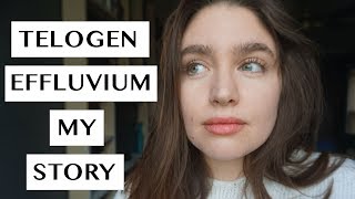 TELOGEN EFFLUVIUM  MY RECOVERY STORY  LAUREN NEWLY [upl. by Aisemaj967]