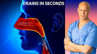 Dr Mandells Sinus Drainage Trick [upl. by Nyasuh]