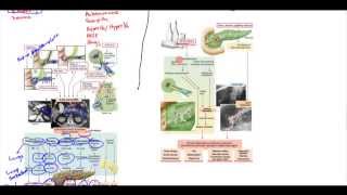 Acute Pancreatitis Chronic Pancreatitis Psuedocyst Adenocarcinoma [upl. by Zeus]