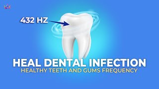 quotDental Infection Treatment Meditation  Healthy Teeth And Gums Frequency  432 Hzquot [upl. by Pavlish]