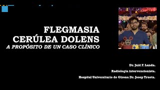 Flegmasia Cerúlea Dolen Revisión a propósito de un caso clínico [upl. by Seyah]