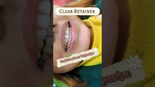 Clear Retainer Retainer after Braces removal Clear Aligner Dental Braces  Dentist in Kathmandu [upl. by Adrahc791]