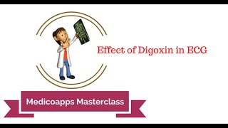 Understanding the Effects on Digoxin on ECG [upl. by Alimat]