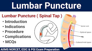 Lumbar Puncture Spinal Tap Procedure and MCQs [upl. by Bearce]