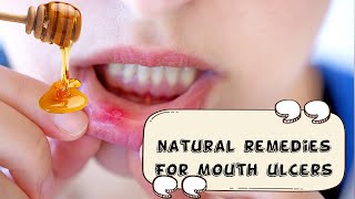 5 Effective Home Remedies For Mouth Ulcers [upl. by Santoro]