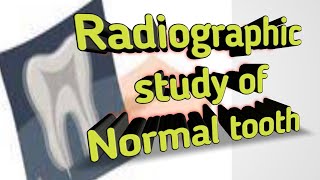 Radiographic study of normal tooth  Radiopaque and Radiolucent Basic of radiograph of tooth struc [upl. by Adnilim]