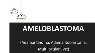 Ameloblastoma  Clinical Features and Treatment of Ameloblastoma [upl. by Surad]