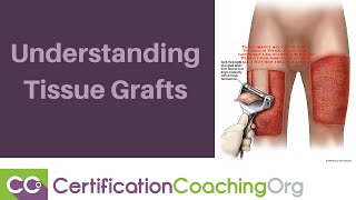 Understanding Tissue Grafts [upl. by Rocky]