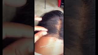 How to correct balding lace front wig toppik baldingsolution lacefrontwig [upl. by Lednik]