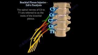 Brachial Plexus Injuries Erbs Paralysis  Everything You Need To Know  Dr Nabil Ebraheim [upl. by Nagar]