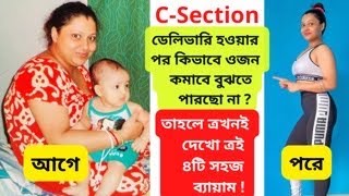 CSection ডেলিভারি হওয়ার পর পেট কমানোর জন্য ৪টি সহজ ব্যায়াম4 Exercises After CSection Delivery [upl. by Salchunas]