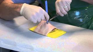 Cricothyroidotomy [upl. by Lorie906]