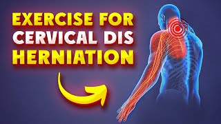 10 Best Cervical Disc Bulge Exercises आसान सर्वाइकल की एक्सरसाइज Cervical disc hernia [upl. by Enait]