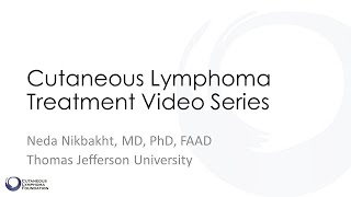 Cutaneous Lymphoma Treatment Series  Video 1 General Overview [upl. by Vladamar]