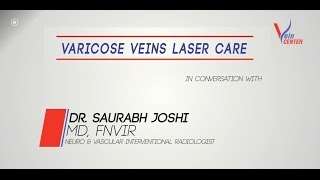 Varicose Veins  Symptoms Laser Treatment Before and After Patient Stories [upl. by Hazem]