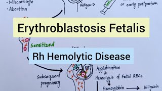 Hemolytic Disease of Fetus amp Newborn [upl. by Naylor]