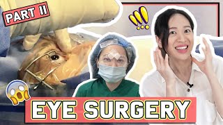 ICL EYE Surgery VLOG Part II  WHOLE SURGERY  COST  QampA  Experience 👁 [upl. by Cleo]