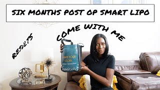 Six Months Post Op Smart Lipo  Come With Me To My Post Op Appt  Revision Update  Results [upl. by Beka]