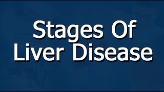 Liver Disease Stages  An Overview [upl. by Rehpotsirhcnhoj89]