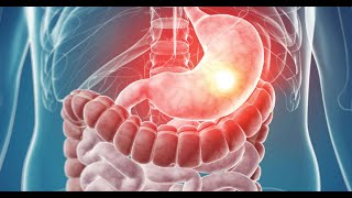 MRCP PART ONEPASSMEDICINE 2021 GASTROENTROLOGY 1 [upl. by Llerdnam399]