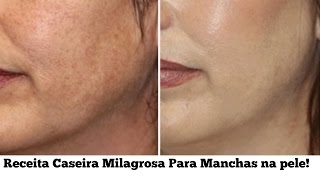 RECEITA CASEIRA PARA ACABAR COM MANCHAS NO ROSTO Rejuvenescimento Celular Caseiro [upl. by Eitsirk]