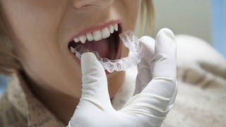 Découvrez les étapes de fabrication de vos aligneurs orthodontiques Primo Orthodontie [upl. by Goodspeed]