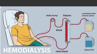 hemodialysis working model Sunlitevlogs [upl. by Bergen]