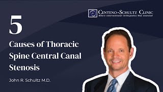 Thoracic Spine Central Canal Stenosis amp Causes amp Symptoms of TS Central Canal Stenosis [upl. by Cazzie636]