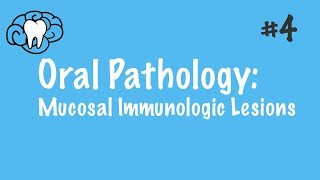 Oral Pathology  Mucosal Immunologic Diseases  INBDE ADAT [upl. by Ballou]