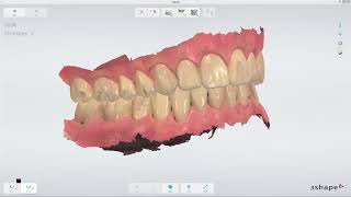 3Shape TRIOS 3 3D ve Renk Kalibrasyonu  3D and Color Calibration [upl. by Aritak]