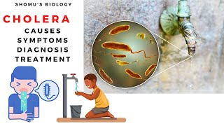 Vibrio cholera causes symptoms prevention and diagnosis [upl. by Alice]