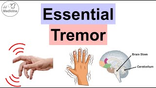 Essential Tremor  Causes Pathophysiology Symptoms Exacerbating Factors Diagnosis Treatment [upl. by Hashim]