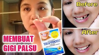 Membuat Gigi Palsu Dengan Produk Temptooth [upl. by Ventre]