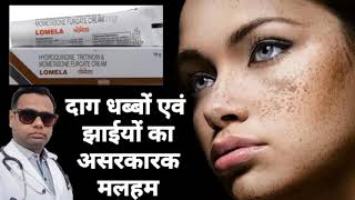 Ointment for melasma। Lomela ointment review Hydroquinone Tretinoin amp Mometasone cream। uses। [upl. by Alusru]