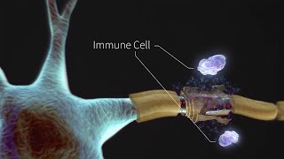 What is Multiple Sclerosis [upl. by Rame]