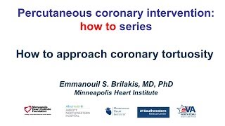 How to approach coronary tortuosity [upl. by Nahgam]