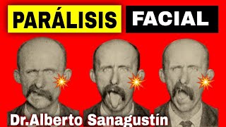 PARÁLISIS FACIAL 💥 Síntomas Causas y Tratamiento [upl. by Ahsiuqet162]