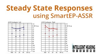 IHS Training Session Auditory Steady State Response Acquisition ASSR [upl. by Sualokin180]